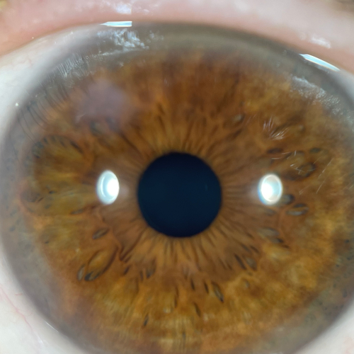 iridologue certifiée