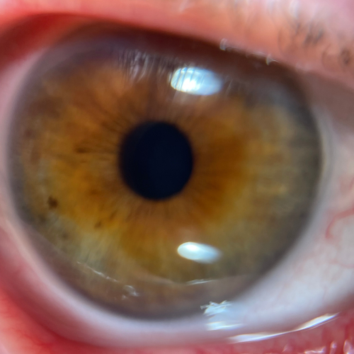 iridologie québec montréal